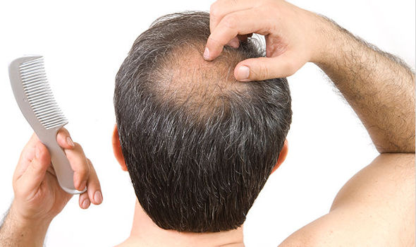  cure your baldness